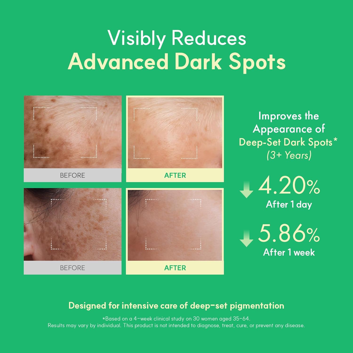 Easydew DW-EGF Melatoning Ampoule 5X - Hydrating Dark Spot Serum with Niacinamide & Glutathione for Uneven Skin - Fast Absorbing Day & Night Ampoule Korean Skin Care (Bottle 1.01 fl oz, EGF 5X) - Image 3