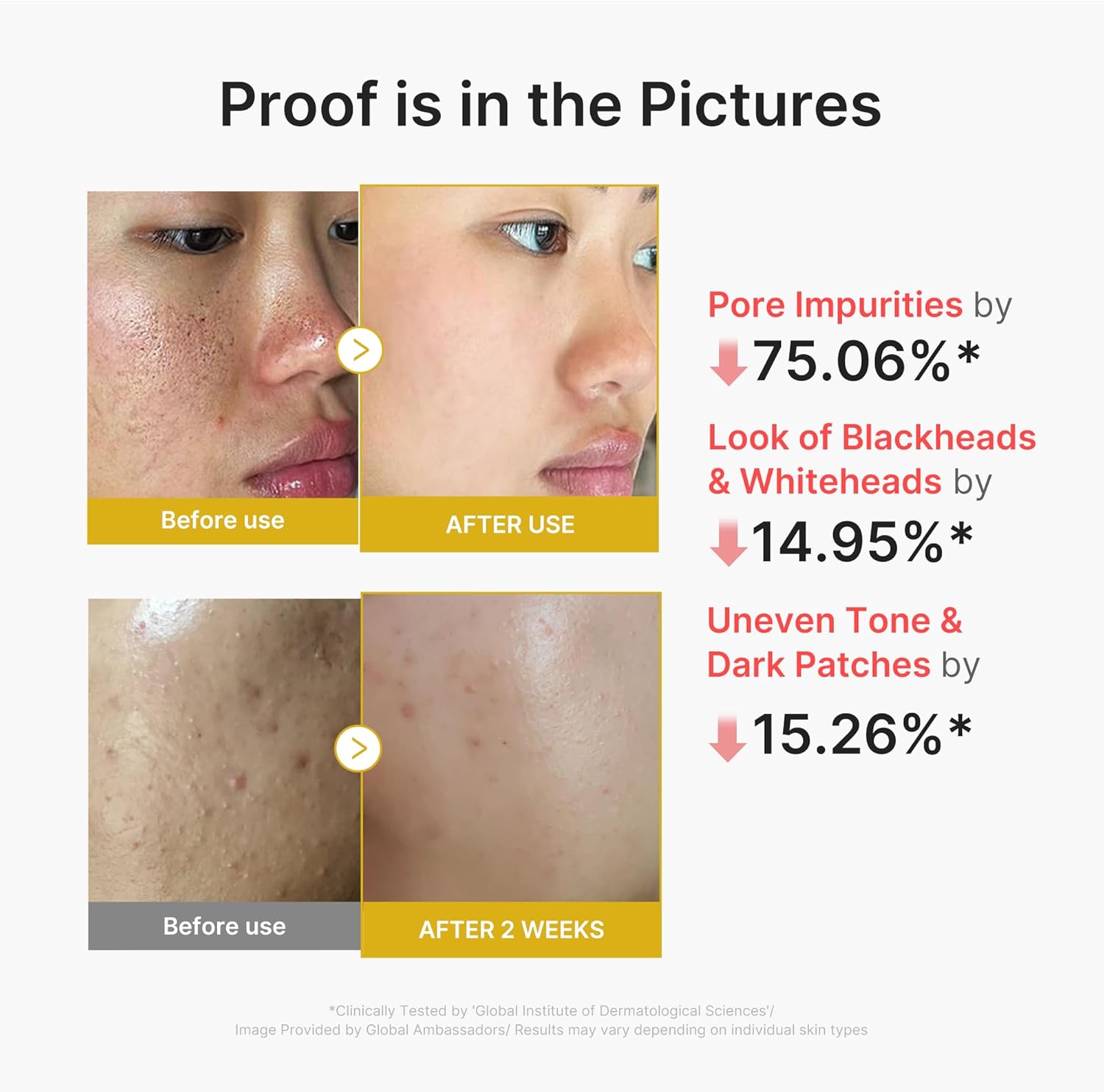 medicube Peel Shot with Turmeric | Reset in One Step | Gentle Exfoliating Serum with BHA, LHA & PHA for Dead Skin Cells, Blackheads & Excess Sebum | For Dull, Rough & Troubled Skin | 2.7 fl.oz - Image 5